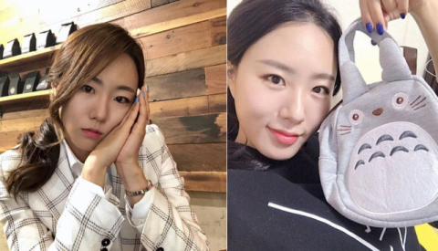 사진-이상화 인스타그램(성형 전 후)