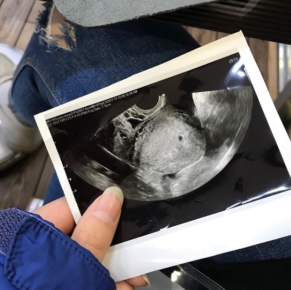 온라인 커뮤니티