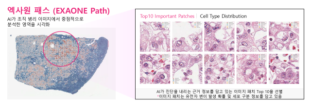 전체 슬라이드 이미지(WSI)에서 암과 관련된 유전자 변이를 예측할 수 있는 엑사원 패스.LG 제공