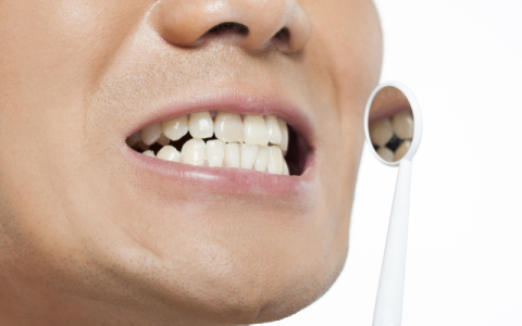 연말까지 스케일링 진료 받으세요