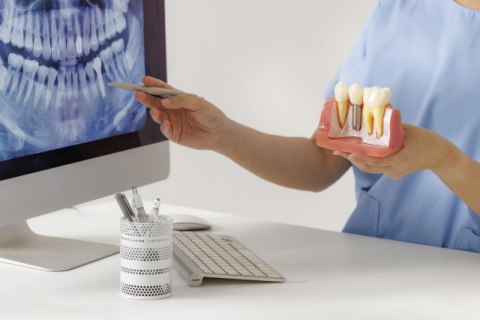 ‘수면·무통치료 임플란트’ 표현에 속지 마세요