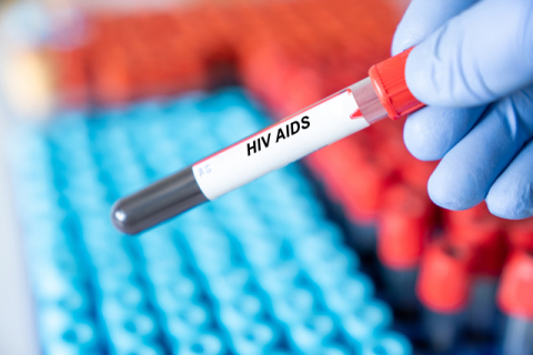 [젊어지는 이야기] 'HIV 양성' 한마디에 무너지는 삶