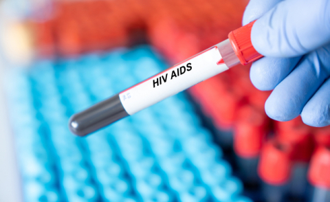 [젊어지는 이야기] 'HIV 양성' 한마디에 무너지는 삶